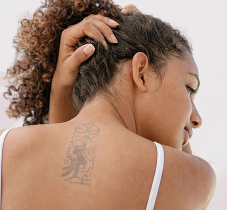 Laser Tattoo Removal Mykonos Medspa Sherman Oaks CA treatment areas m 22